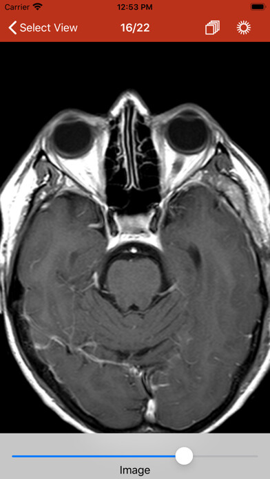 Emulate iPhone app DICOM Spectator using MyAndroid