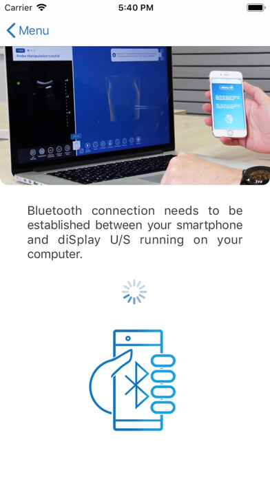 Run android online APK diSplay U/S probe from MyAndroid or emulate diSplay U/S probe using MyAndroid Run android online APK diSplay U/S probe from MyAndroid or emulate diSplay U/S probe using MyAndroid