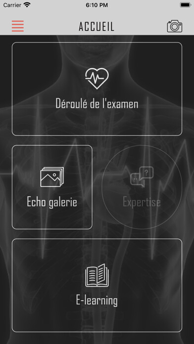Emulate iPhone app EasyEcho V2 using MyAndroid Emulate iPhone app EasyEcho V2 using MyAndroid