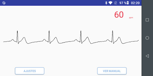 Emulate Android APK ECG Anywhere