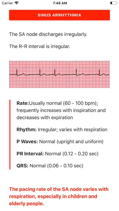 Emulate iPhone app ECG FlashCards Pro using MyAndroid Emulate iPhone app ECG FlashCards Pro using MyAndroid