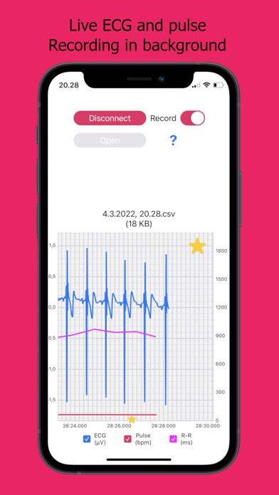 Emulate iPhone app ECG Logger for Polar H10 using MyAndroid