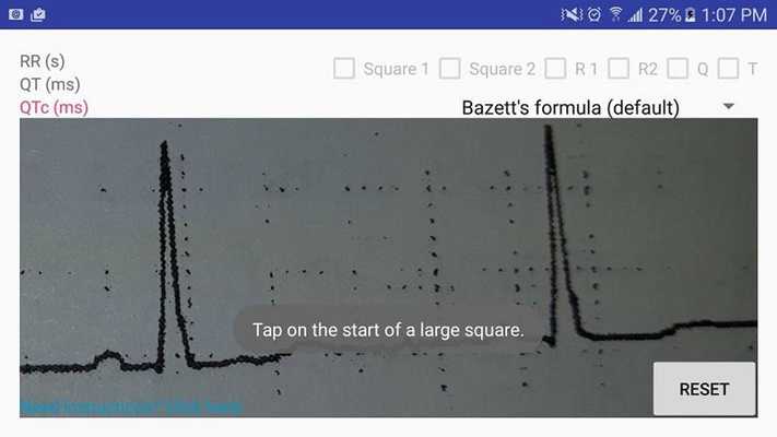 Emulate Android APK ECG: QTc Calculator