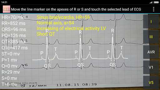 Run android online APK ECG Reader 2 free from MyAndroid or emulate ECG Reader 2 free using MyAndroid