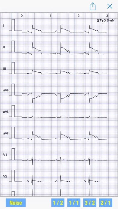 Emulate iPhone app ECG Simulator using MyAndroid Emulate iPhone app ECG Simulator using MyAndroid