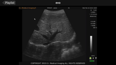 Emulate iPhone app E.I. Medical Imaging using MyAndroid Emulate iPhone app E.I. Medical Imaging using MyAndroid