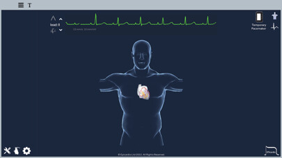 Emulate iPhone app Epicardio Heart Simulator using MyAndroid Emulate iPhone app Epicardio Heart Simulator using MyAndroid