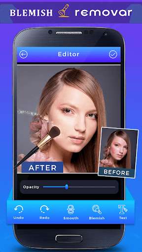 Run android online APK Face Blemish Remover - Remove Pimple from MyAndroid or emulate Face Blemish Remover - Remove Pimple using MyAndroid Run android online APK Face Blemish Remover - Remove Pimple from MyAndroid or emulate Face Blemish Remover - Remove Pimple using MyAndroid
