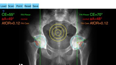 Emulate iPhone app FemoroAcetabularImpingementApp using MyAndroid Emulate iPhone app FemoroAcetabularImpingementApp using MyAndroid