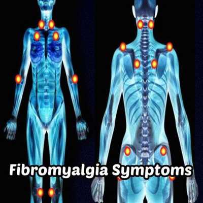 Emulate Android APK Fibromyalgia Symptoms Causes Emulate Android APK Fibromyalgia Symptoms Causes