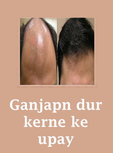 Run android online APK Ganjapn dur kerne ke upay from MyAndroid or emulate Ganjapn dur kerne ke upay using MyAndroid