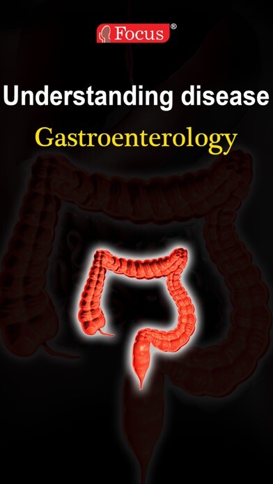 Emulate iPhone app Gastroenterology - Understanding Disease using MyAndroid Emulate iPhone app Gastroenterology - Understanding Disease using MyAndroid