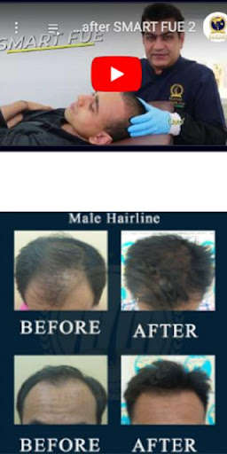Run android online APK Hair Transplant Malaysia from MyAndroid or emulate Hair Transplant Malaysia using MyAndroid Run android online APK Hair Transplant Malaysia from MyAndroid or emulate Hair Transplant Malaysia using MyAndroid