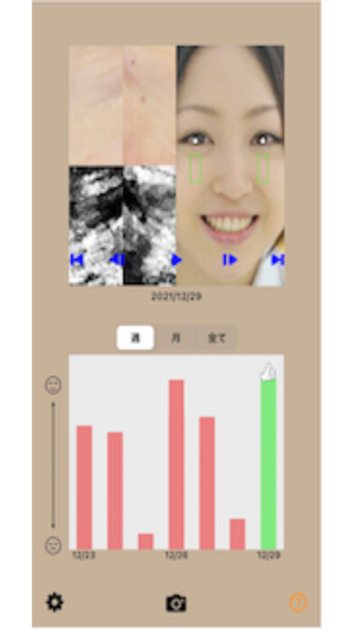 Emulate iPhone app hbSkinBeat using MyAndroid Emulate iPhone app hbSkinBeat using MyAndroid