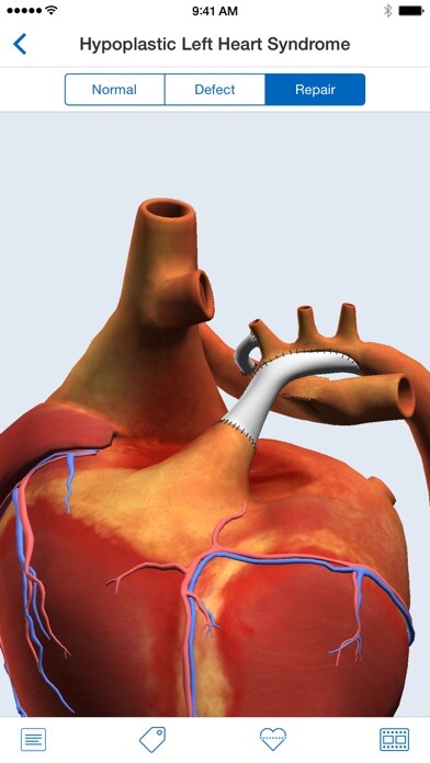 Emulate iPhone app Heartpedia using MyAndroid Emulate iPhone app Heartpedia using MyAndroid