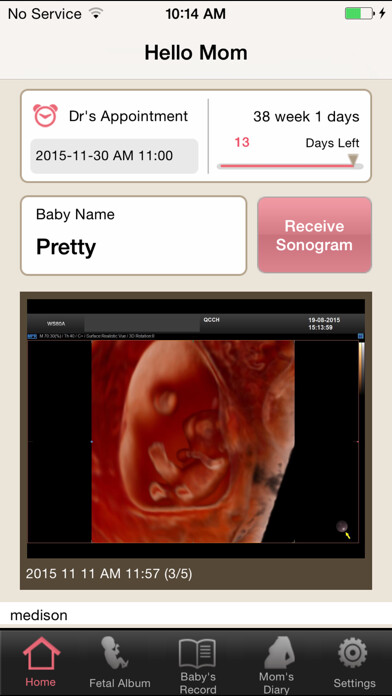 Emulate iPhone app Hello Mom for Samsung Medison using MyAndroid Emulate iPhone app Hello Mom for Samsung Medison using MyAndroid