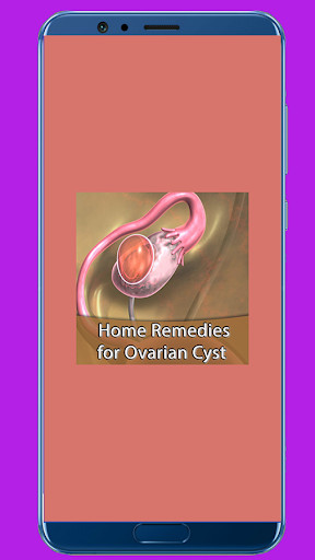 Run android online APK Home Remedies for Ovarian Cyst from MyAndroid or emulate Home Remedies for Ovarian Cyst using MyAndroid Run android online APK Home Remedies for Ovarian Cyst from MyAndroid or emulate Home Remedies for Ovarian Cyst using MyAndroid