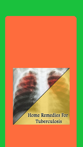 Run android online APK Home Remedies For Tuberculosis (TB) from MyAndroid or emulate Home Remedies For Tuberculosis (TB) using MyAndroid