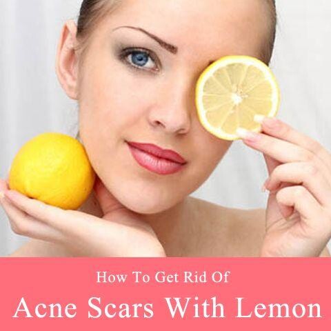 Emulate Android APK How To Get Rid Of Acne Emulate Android APK How To Get Rid Of Acne