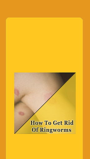 Run android online APK How To Get Rid Of Ringworms from MyAndroid or emulate How To Get Rid Of Ringworms using MyAndroid