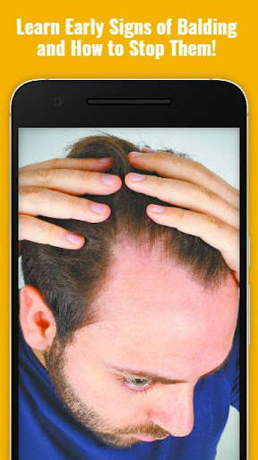 Run android online APK How to Stop Baldness Thinning Hair (Guide) from MyAndroid or emulate How to Stop Baldness Thinning Hair (Guide) using MyAndroid