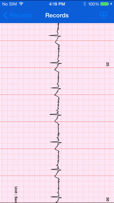 Emulate iPhone app iBP ECG using MyAndroid Emulate iPhone app iBP ECG using MyAndroid