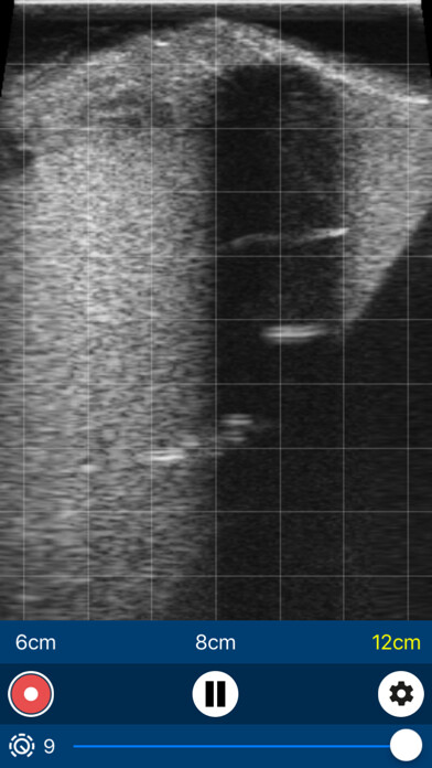 Emulate iPhone app IMV Go Scan using MyAndroid