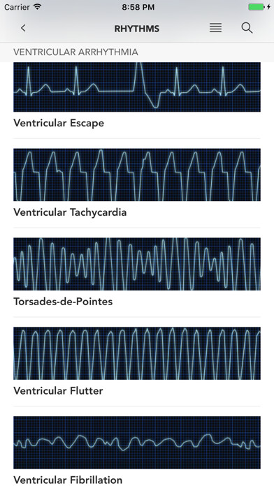 Emulate iPhone app Instant ECG - Mastery of EKG using MyAndroid