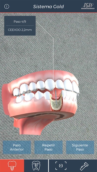 Emulate iPhone app ISI Dental using MyAndroid Emulate iPhone app ISI Dental using MyAndroid