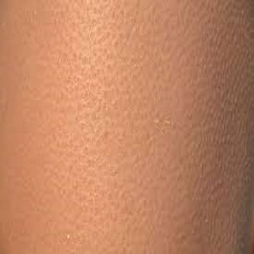 Emulate Android APK Keratosis Pilaris Treatment Emulate Android APK Keratosis Pilaris Treatment