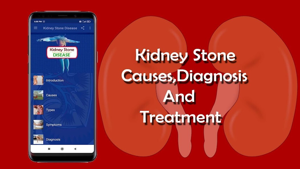 Run android online APK Kidney Stone - Causes, Diagnos from MyAndroid or emulate Kidney Stone - Causes, Diagnos using MyAndroid Run android online APK Kidney Stone - Causes, Diagnos from MyAndroid or emulate Kidney Stone - Causes, Diagnos using MyAndroid