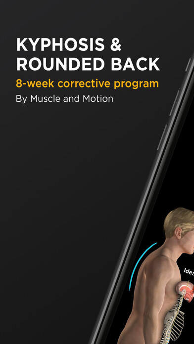Emulate iPhone app Kyphosis & Rounded Back using MyAndroid Emulate iPhone app Kyphosis & Rounded Back using MyAndroid