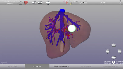 Emulate iPhone app Liver Surgery AP-HP using MyAndroid