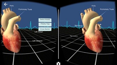 Emulate iPhone app Living Heart for Cardboard VR using MyAndroid Emulate iPhone app Living Heart for Cardboard VR using MyAndroid
