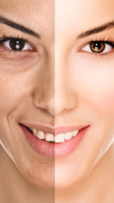 Emulate iPhone app Look Younger - Perform Plastic Surgery on Photos using MyAndroid