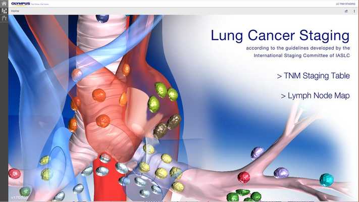 Emulate Android APK Lung Cancer Staging Table Emulate Android APK Lung Cancer Staging Table