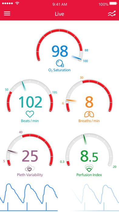 Emulate iPhone app Masimo Personal Health using MyAndroid Emulate iPhone app Masimo Personal Health using MyAndroid