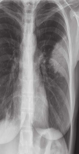 Run android online APK Medical X-ray Interpretation With 200++ Cases from MyAndroid or emulate Medical X-ray Interpretation With 200++ Cases using MyAndroid Run android online APK Medical X-ray Interpretation With 200++ Cases from MyAndroid or emulate Medical X-ray Interpretation With 200++ Cases using MyAndroid