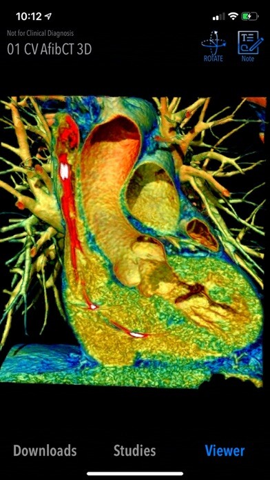 Emulate iPhone app MedVizi™ CT-MRI Viewer using MyAndroid