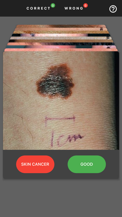 Run android online APK MelanomaExam from MyAndroid or emulate MelanomaExam using MyAndroid