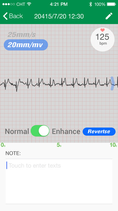 Emulate iPhone app MiCor using MyAndroid Emulate iPhone app MiCor using MyAndroid