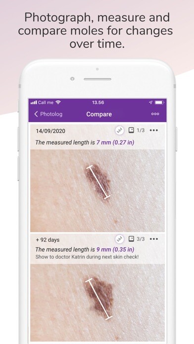 Emulate iPhone app Miiskin Skin & Dermatology using MyAndroid