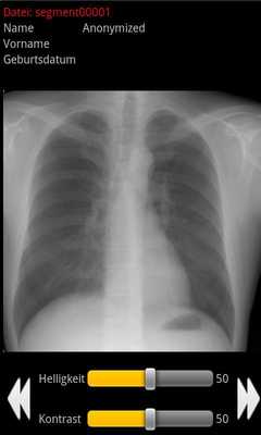 Emulate Android APK Minimal Dicom Viewer