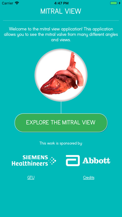 Emulate iPhone app Mitral View using MyAndroid Emulate iPhone app Mitral View using MyAndroid