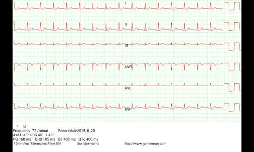 Emulate Android APK Mobile patient monitoring Emulate Android APK Mobile patient monitoring