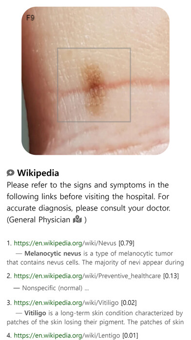 Emulate iPhone app Model Dermatol - Wiki using MyAndroid Emulate iPhone app Model Dermatol - Wiki using MyAndroid