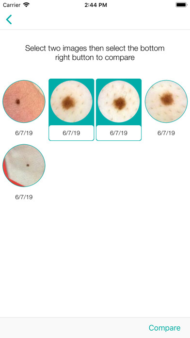 Emulate iPhone app MoleScope™ using MyAndroid Emulate iPhone app MoleScope™ using MyAndroid