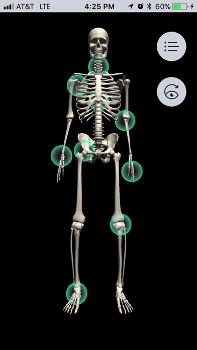 Emulate iPhone app Musculoskeletal Pro Consult using MyAndroid Emulate iPhone app Musculoskeletal Pro Consult using MyAndroid