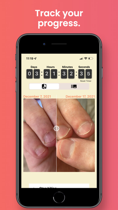 Emulate iPhone app NailKeeper - Stop Biting Nails using MyAndroid Emulate iPhone app NailKeeper - Stop Biting Nails using MyAndroid
