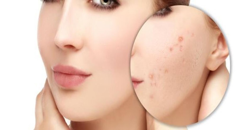 Run android online APK Natural masks from MyAndroid or emulate Natural masks using MyAndroid Run android online APK Natural masks from MyAndroid or emulate Natural masks using MyAndroid